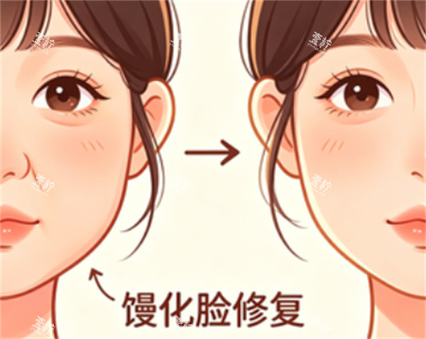 馒化脸修复前后对比.jpg