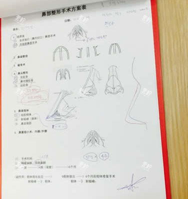 北京柏丽医疗美容医院李劲良做鼻子设计.jpg 北京柏丽医疗美容医院李劲良做鼻子设计.jpg