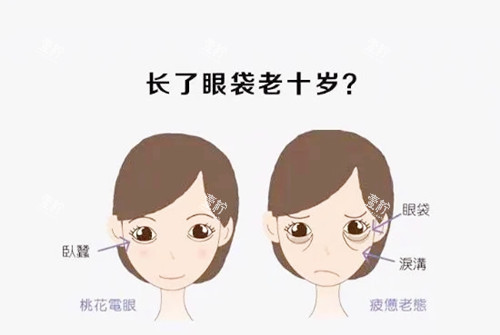 祛眼袋对比.webp.jpg 祛眼袋对比.webp.jpg
