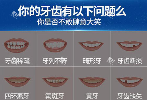 哪些牙齿需要做牙冠修复.jpg