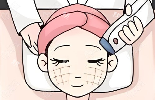热玛吉操作过程.jpg