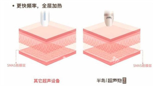 在天津时光整形美容门诊部做皮肤选卢宁靠谱吗面诊会不会硬推项目加钱