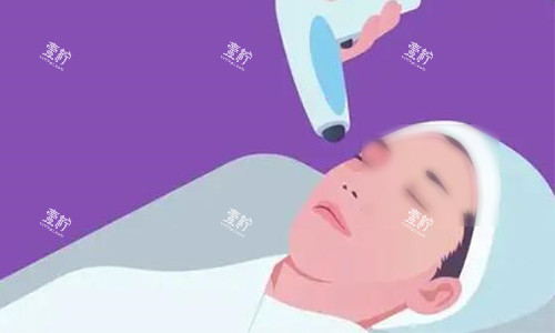 热玛吉操作示意图.jpg 热玛吉操作示意图.jpg