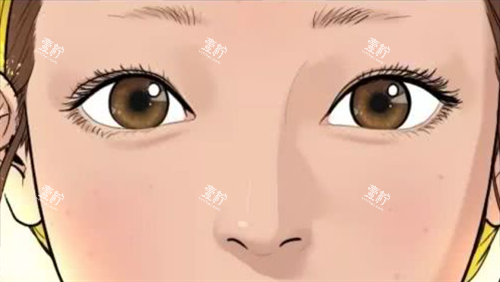 自然双眼皮.png