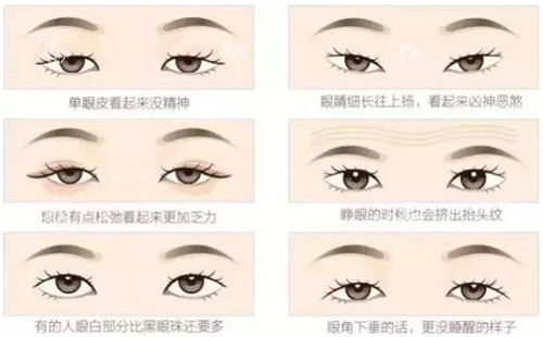 不同可以进行双眼皮的眼睛.jpg 不同可以进行双眼皮的眼睛.jpg