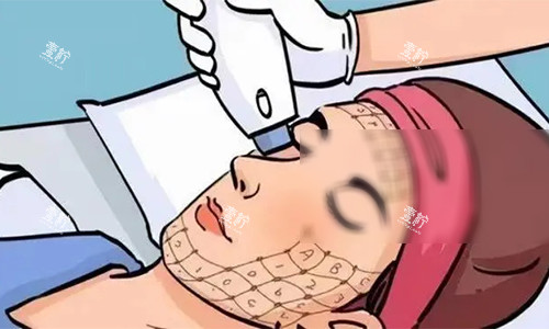 热玛吉的动画操作图.jpg 热玛吉的动画操作图.jpg