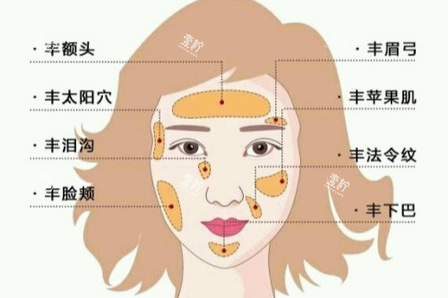 自体脂肪面部填充卡通图一览.jpg 自体脂肪面部填充卡通图一览.jpg