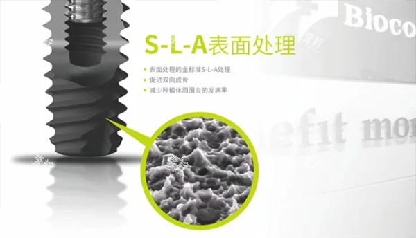 百康特种植牙种植体表面设计.png 百康特种植牙种植体表面设计.png