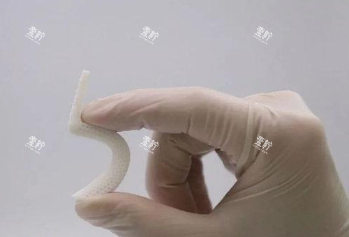 超体隆鼻照片展示图.jpg 超体隆鼻照片展示图.jpg