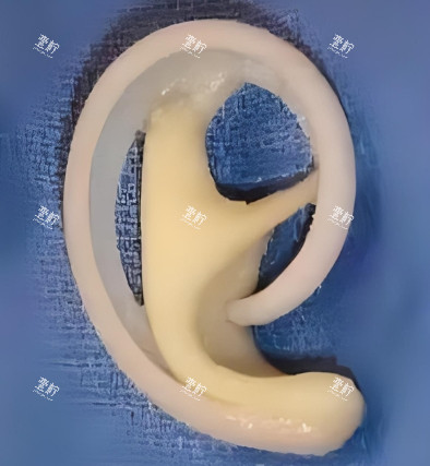耳再造手术假体照片.png 耳再造手术假体照片.png