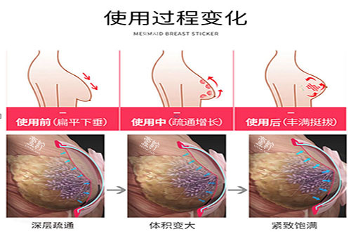 魔力贴丰胸使用变化图.jpg