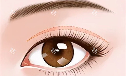 双眼皮特写展示图.jpg 双眼皮特写展示图.jpg