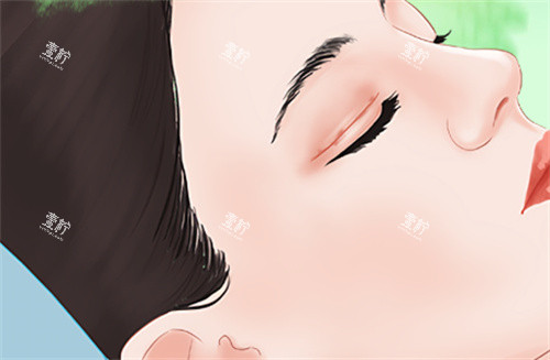 需要双眼皮修复的眼睛.jpg 需要双眼皮修复的眼睛.jpg