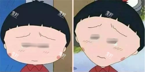 打针瘦脸前后明显对比图.png
