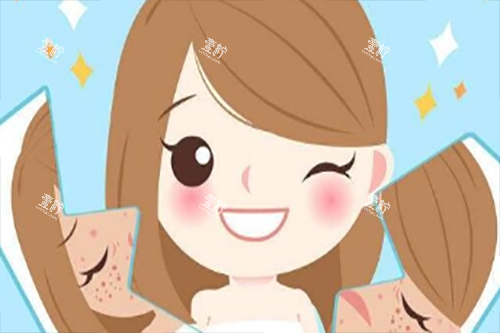 激光美肤卡通.jpg