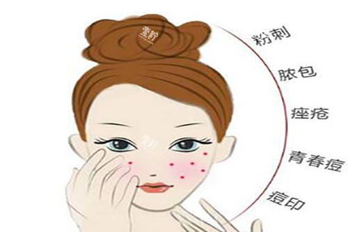 激光美肤适应症.jpg