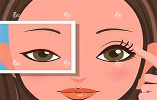 双眼皮对比.png