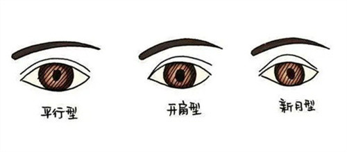 双眼皮.jpg
