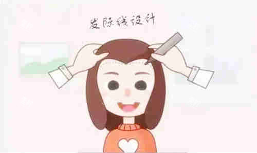 植发设计图示.jpg