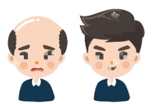 植发前后对比示意图.png