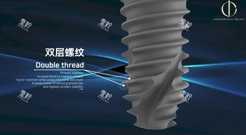 韩一种植体螺纹设计.png 韩一种植体螺纹设计.png