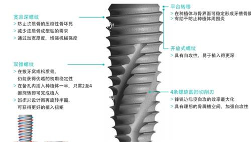 韩国柯威尔种植牙介绍.png
