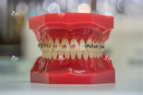 牙齿矫正宣传展示.jpg