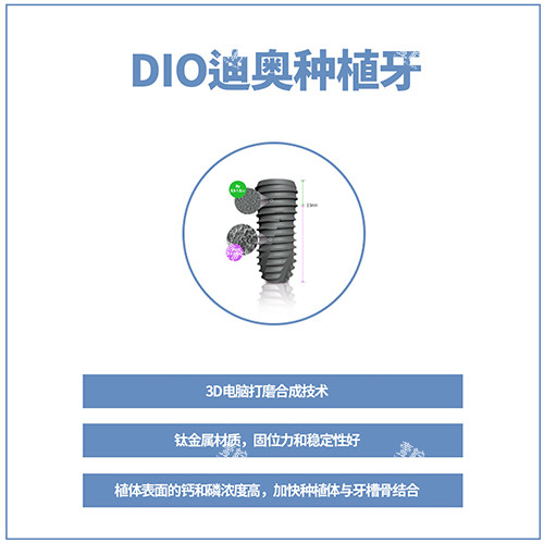 韩国DIO种植牙讲解图.jpg