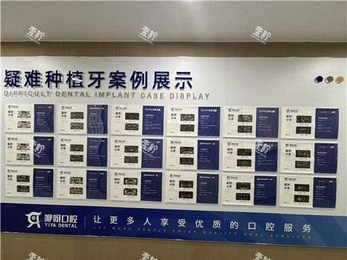 种植牙实例展示图.jpg