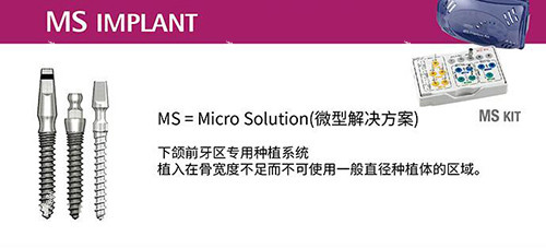 奥齿泰种植牙MS系列.jpg