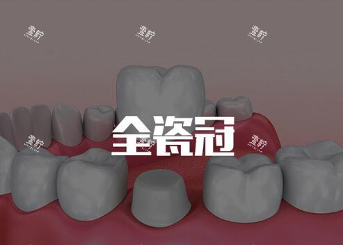 全瓷冠修复改善.jpg