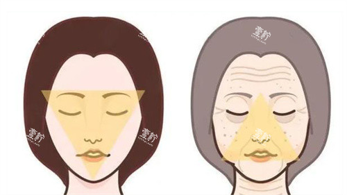抗衰除皱前后对比.jpg