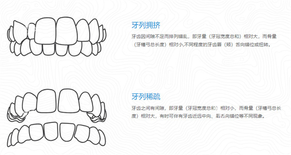 美婕氏牙齿矫正器可佩戴情况.jpg