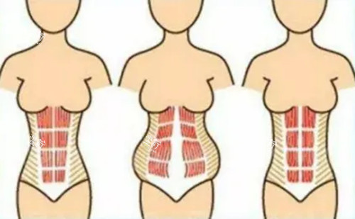 曙光医院介绍，吸脂体雕是主打口碑服务也相当贴心，确实挺让人省心