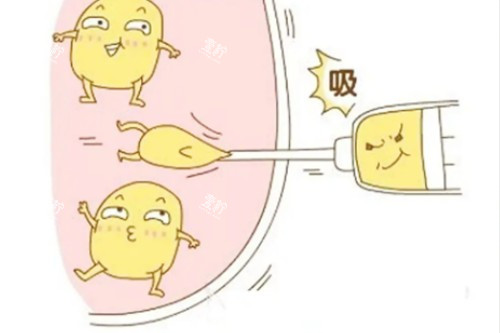 吸脂卡通图.jpg