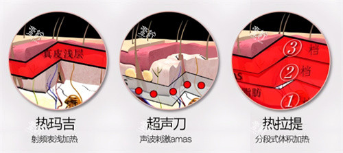 面部提升项目对比.jpg 面部提升项目对比.jpg