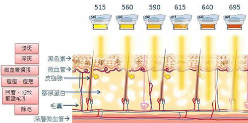 光子嫩肤原理图.jpg