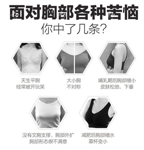 胸部整形适应症.jpg