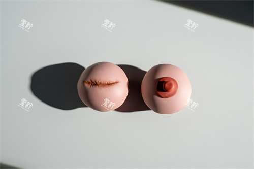 乳晕手术整形展示图.jpg