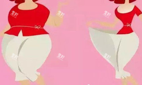 大腿吸脂前后对比图.jpg 大腿吸脂前后对比图.jpg