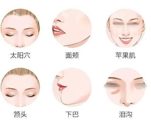 面部填充部位一览图.png 面部填充部位一览图.png