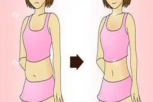 腰腹吸脂示意图卡通.jpg