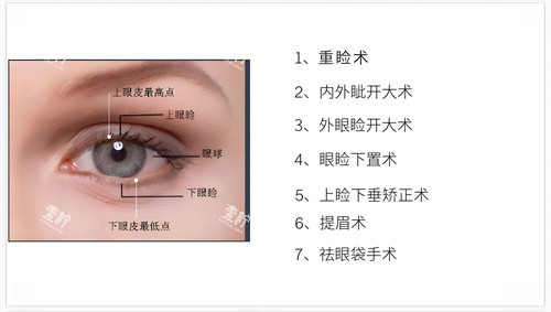 眼综合整形包含的部分项目演示图.jpg