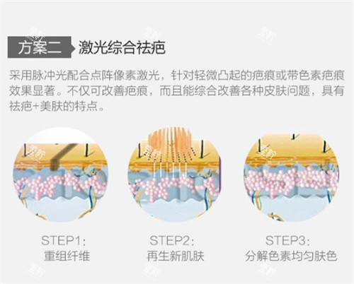 激光祛疤图示.jpg