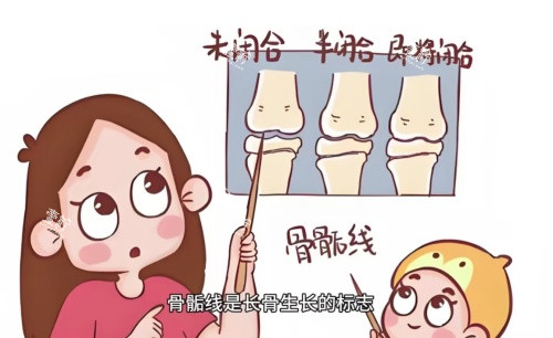 骨骺线联合提升示意图.jpg