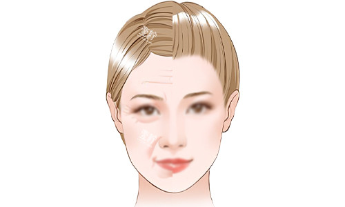 面部抗衰老的意义.jpg 面部抗衰老的意义.jpg