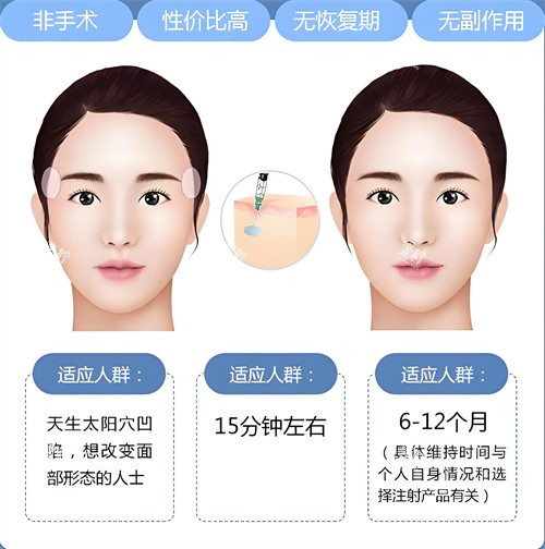玻尿酸注射填充适合人群与原理动画图.jpg 玻尿酸注射填充适合人群与原理动画图.jpg
