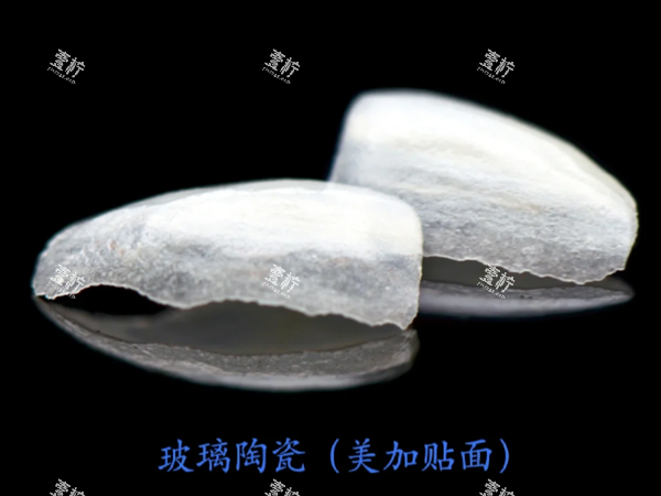 美加玻璃陶瓷贴面.png 美加玻璃陶瓷贴面.png