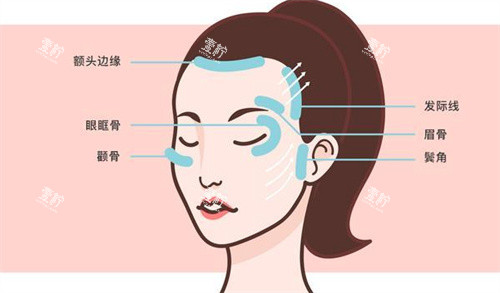 面部提升区域.jpg 面部提升区域.jpg