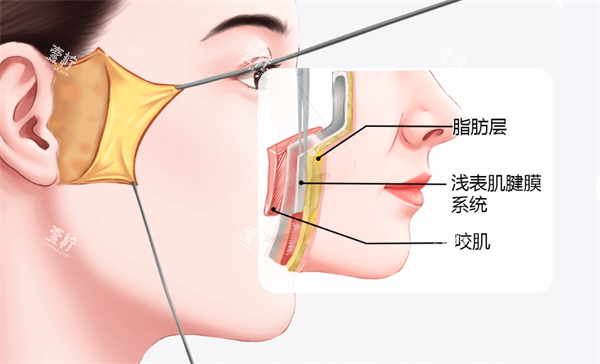面部拉皮层次.png 面部拉皮层次.png